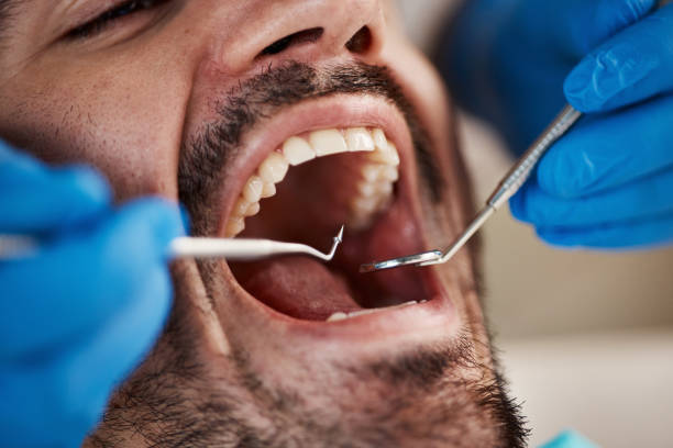 Tooth Infection Emergency Dentist in FL